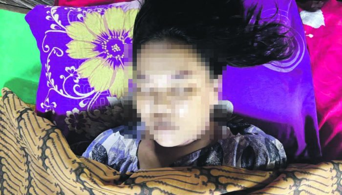 Seorang Perempuan di Katingan Gantung Diri dalam Toilet