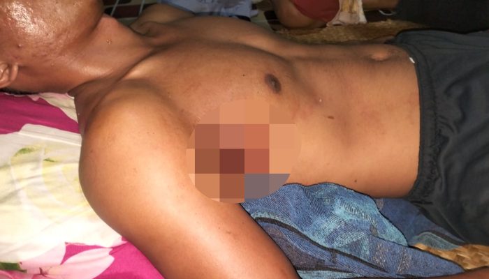 Kontroversi Ninja Sawit di PT KKP : Empat Warga Luka, Aparat Diperiksa